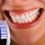 If left untreated, gingivitis can eventually lead to the loss of gum tissue, bone supporting the teeth & eventually the actual teeth.