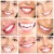 Longing for a brighter smile? There are plenty of teeth whitening options available!