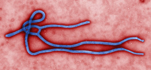 There have no cases of Ebola in Arizona to date. However, dental professionals should be knowledgeable about the disease and infection control protocols.