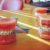 3 Factors to Consider While Bracing for Braces